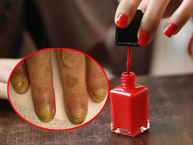Tác hại của sơn móng tay loại rẻ tiền có thể gây rối loạn sinh sản, ung thư - Làm đẹp