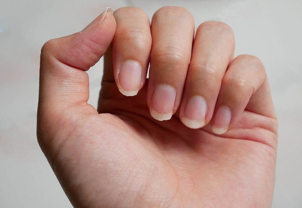 Móng tay nói gì về sức khỏe của bạn? | Vinmec